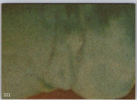 1977 TOPPS STAR WARS Trading Cards - Orange Series 4 - U Pick